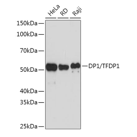 Western Blot - Anti-DP1 Antibody [ARC1202] (A308679) - Antibodies.com