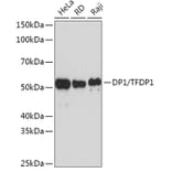 Western Blot - Anti-DP1 Antibody [ARC1202] (A308679) - Antibodies.com