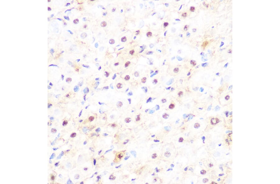 Immunohistochemistry - Anti-DP1 Antibody [ARC1202] (A308679) - Antibodies.com