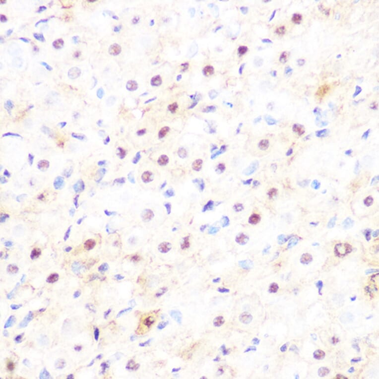 Immunohistochemistry - Anti-DP1 Antibody [ARC1202] (A308679) - Antibodies.com