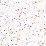 Immunohistochemistry - Anti-DP1 Antibody [ARC1202] (A308679) - Antibodies.com