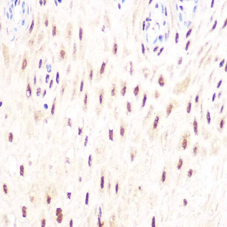 Immunohistochemistry - Anti-DP1 Antibody [ARC1202] (A308679) - Antibodies.com