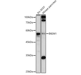 Western Blot - Anti-INSM1 Antibody (A308680) - Antibodies.com