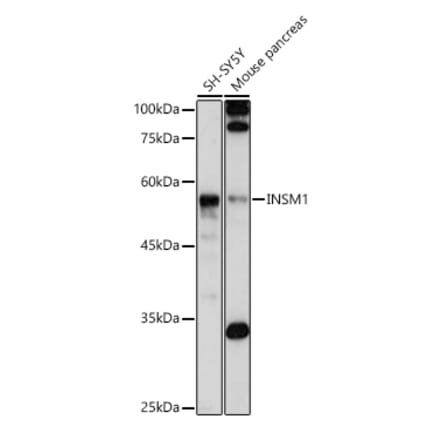 Western Blot - Anti-INSM1 Antibody (A308680) - Antibodies.com