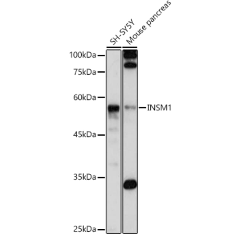 Western Blot - Anti-INSM1 Antibody (A308680) - Antibodies.com