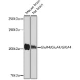 Western Blot - Anti-GluA4 Antibody [ARC1045] (A308681) - Antibodies.com