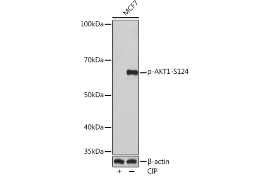 Western Blot - Anti-AKT1 (phospho Ser124) Antibody [ARC1526] (A308682) - Antibodies.com