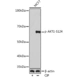 Western Blot - Anti-AKT1 (phospho Ser124) Antibody [ARC1526] (A308682) - Antibodies.com