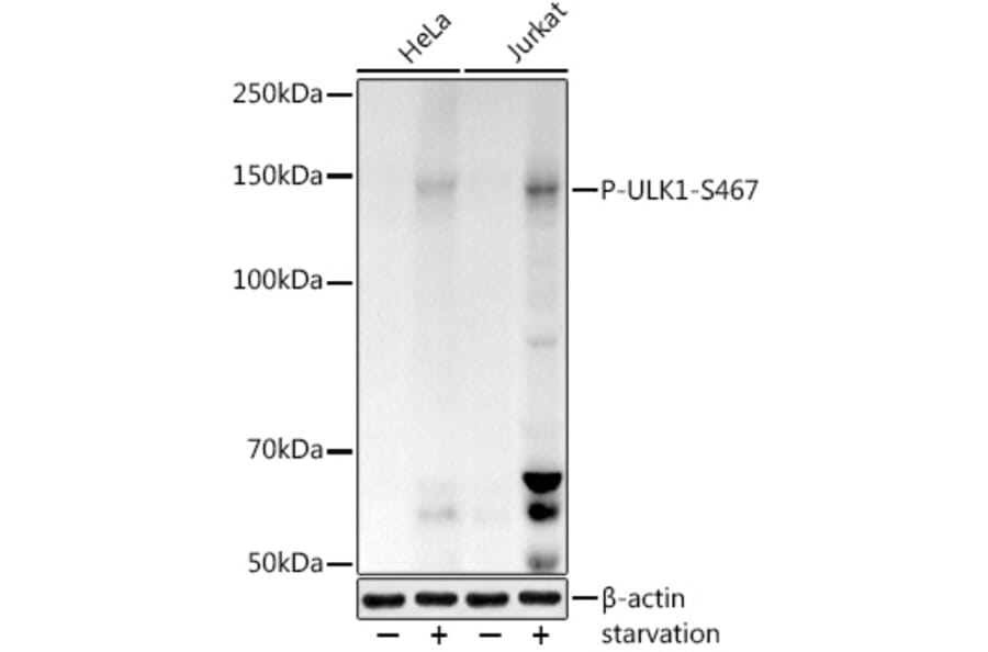 Western Blot - Anti-ULK1 (phospho Ser467) Antibody (A308683) - Antibodies.com