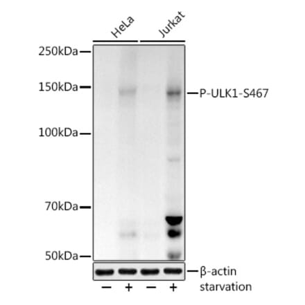 Western Blot - Anti-ULK1 (phospho Ser467) Antibody (A308683) - Antibodies.com