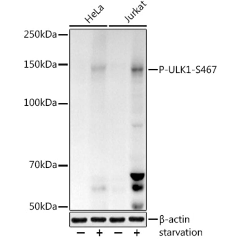 Western Blot - Anti-ULK1 (phospho Ser467) Antibody (A308683) - Antibodies.com