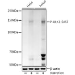 Western Blot - Anti-ULK1 (phospho Ser467) Antibody (A308683) - Antibodies.com
