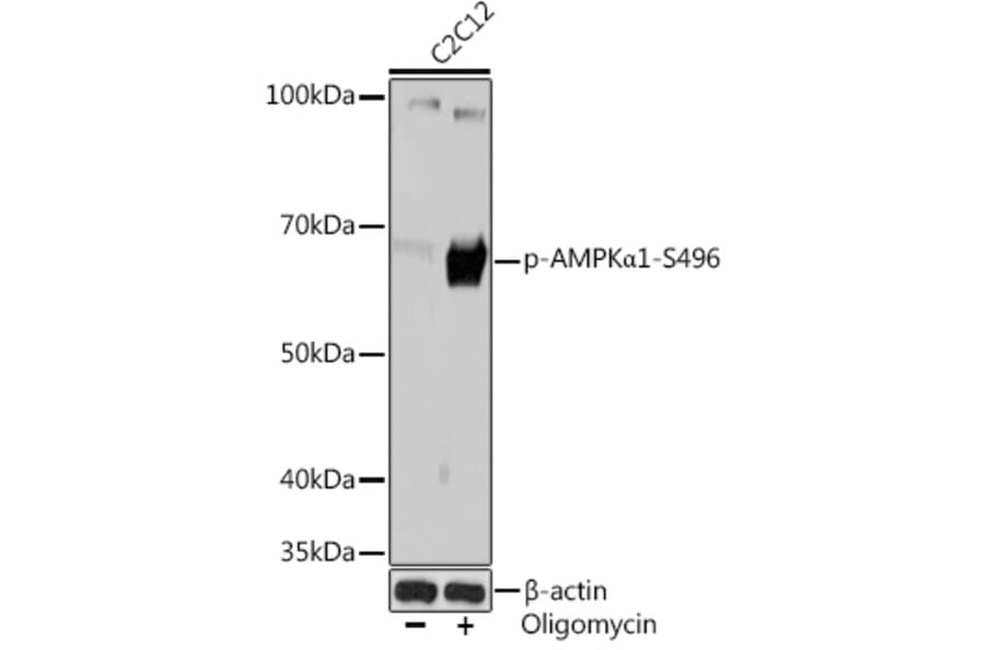 Western Blot - Anti-AMPK alpha 1 (phospho Ser496) Antibody [ARC1547] (A308684) - Antibodies.com
