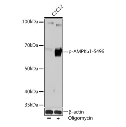 Western Blot - Anti-AMPK alpha 1 (phospho Ser496) Antibody [ARC1547] (A308684) - Antibodies.com