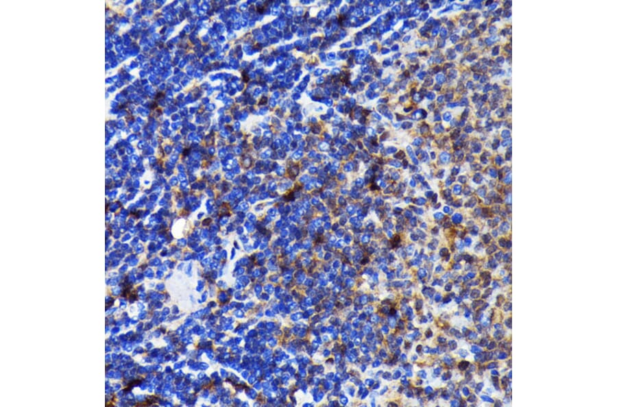 Immunohistochemistry - Anti-Caspase-3 Antibody [ARC0143] (A308685) - Antibodies.com