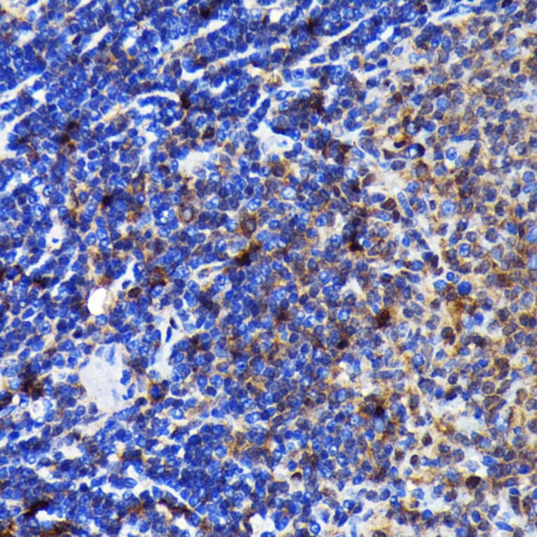 Immunohistochemistry - Anti-Caspase-3 Antibody [ARC0143] (A308685) - Antibodies.com
