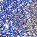 Immunohistochemistry - Anti-Caspase-3 Antibody [ARC0143] (A308685) - Antibodies.com