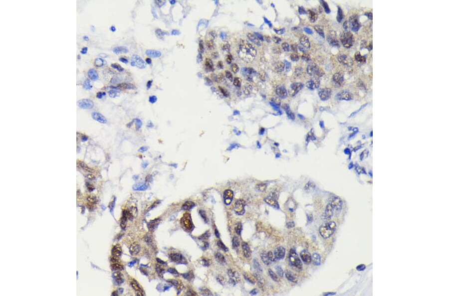 Immunohistochemistry - Anti-Caspase-3 Antibody [ARC0143] (A308685) - Antibodies.com