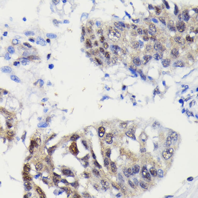 Immunohistochemistry - Anti-Caspase-3 Antibody [ARC0143] (A308685) - Antibodies.com