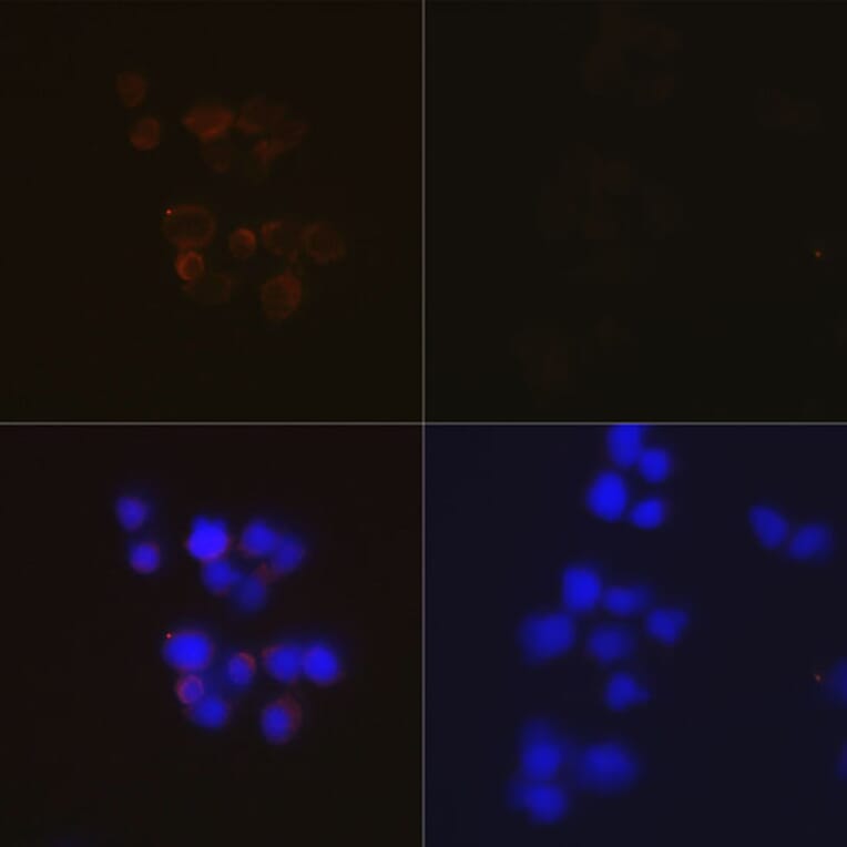 Immunofluorescence - Anti-Caspase-3 Antibody [ARC0143] (A308685) - Antibodies.com
