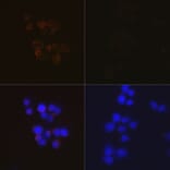 Immunofluorescence - Anti-Caspase-3 Antibody [ARC0143] (A308685) - Antibodies.com