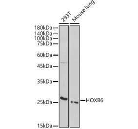 Western Blot - Anti-HOXB6 Antibody (A308687) - Antibodies.com