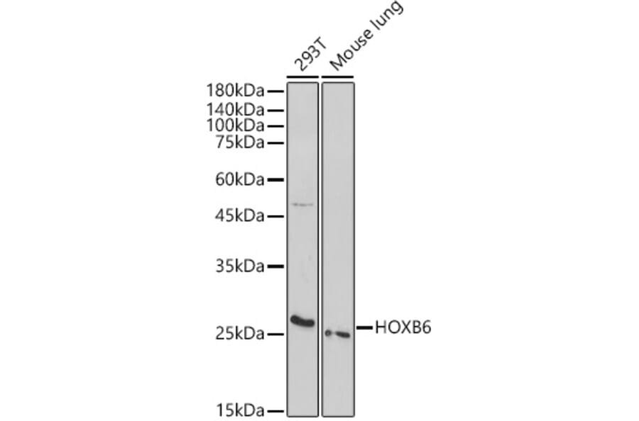 Western Blot - Anti-HOXB6 Antibody (A308687) - Antibodies.com
