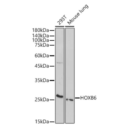 Western Blot - Anti-HOXB6 Antibody (A308687) - Antibodies.com