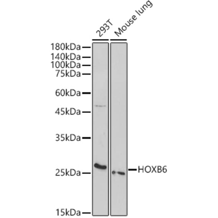Western Blot - Anti-HOXB6 Antibody (A308687) - Antibodies.com