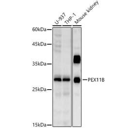Western Blot - Anti-PEX11B Antibody [ARC2940] (A308688) - Antibodies.com