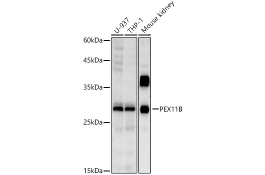Western Blot - Anti-PEX11B Antibody [ARC2940] (A308688) - Antibodies.com