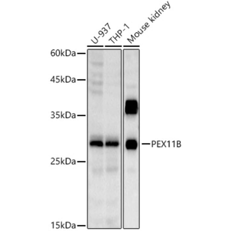 Western Blot - Anti-PEX11B Antibody [ARC2940] (A308688) - Antibodies.com