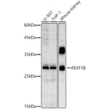 Western Blot - Anti-PEX11B Antibody [ARC2940] (A308688) - Antibodies.com