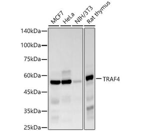 Western Blot - Anti-TRAF4 Antibody [ARC57454] (A308689) - Antibodies.com