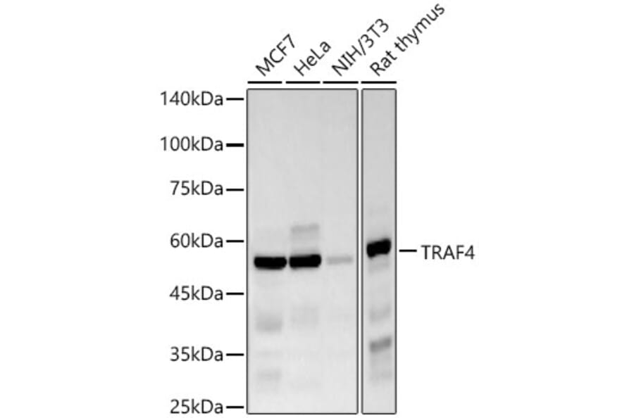 Western Blot - Anti-TRAF4 Antibody [ARC57454] (A308689) - Antibodies.com