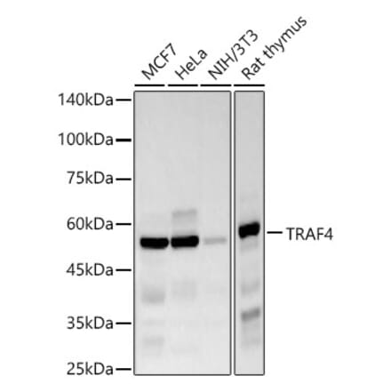 Western Blot - Anti-TRAF4 Antibody [ARC57454] (A308689) - Antibodies.com