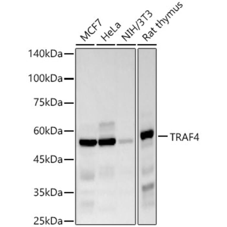 Western Blot - Anti-TRAF4 Antibody [ARC57454] (A308689) - Antibodies.com