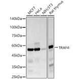 Western Blot - Anti-TRAF4 Antibody [ARC57454] (A308689) - Antibodies.com