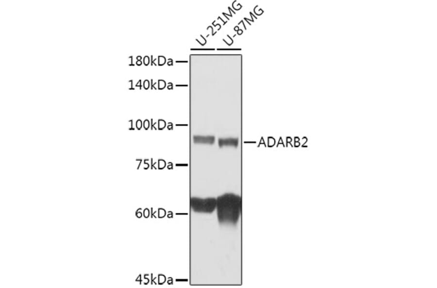 Western Blot - Anti-ADARB2 Antibody (A308690) - Antibodies.com