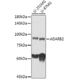 Western Blot - Anti-ADARB2 Antibody (A308690) - Antibodies.com