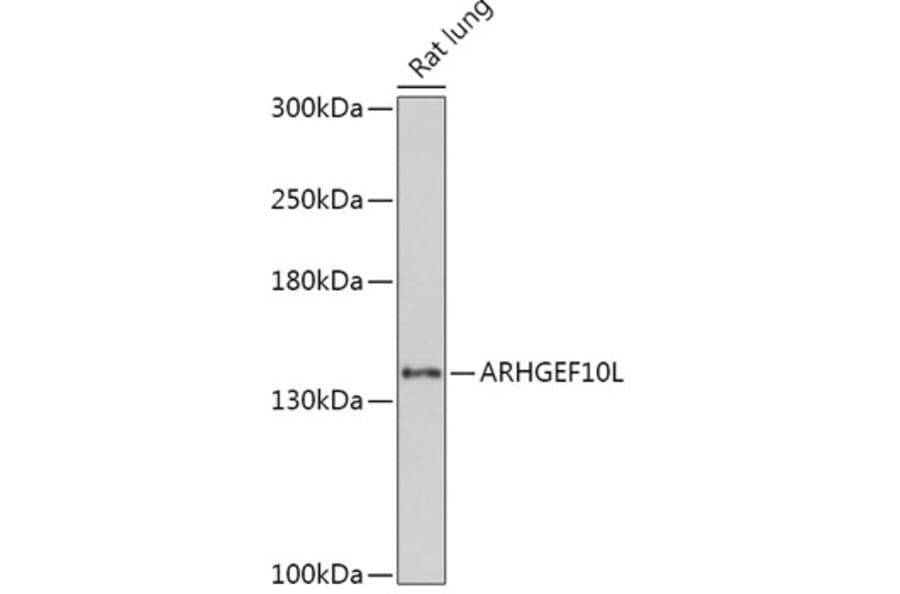 Western Blot - Anti-ARHGEF10L Antibody (A308692) - Antibodies.com