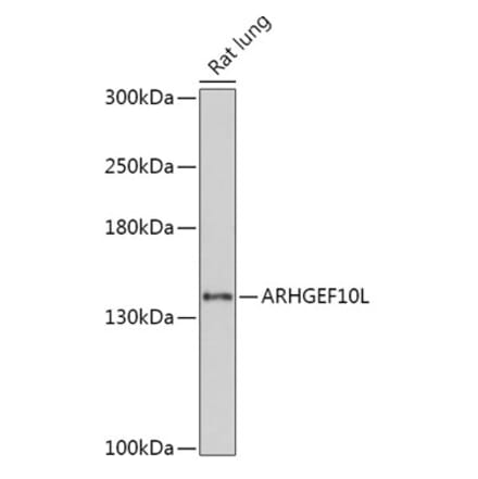 Western Blot - Anti-ARHGEF10L Antibody (A308692) - Antibodies.com