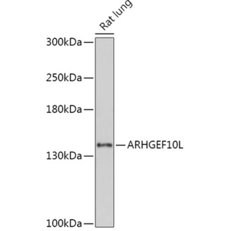 Western Blot - Anti-ARHGEF10L Antibody (A308692) - Antibodies.com