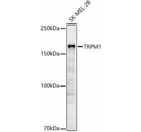 Western Blot - Anti-TRPM1 Antibody (A308697) - Antibodies.com