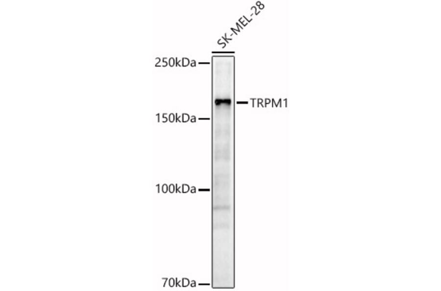 Western Blot - Anti-TRPM1 Antibody (A308697) - Antibodies.com