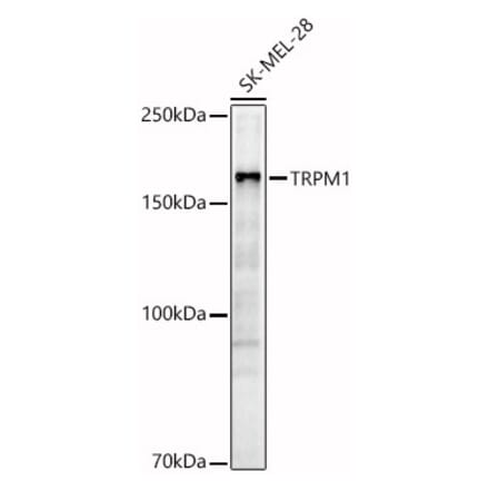 Western Blot - Anti-TRPM1 Antibody (A308697) - Antibodies.com