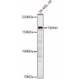 Western Blot - Anti-TRPM1 Antibody (A308697) - Antibodies.com