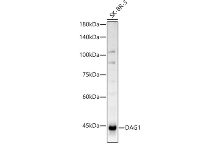 Western Blot - Anti-DAG1 Antibody (A308698) - Antibodies.com