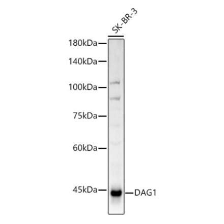 Western Blot - Anti-DAG1 Antibody (A308698) - Antibodies.com