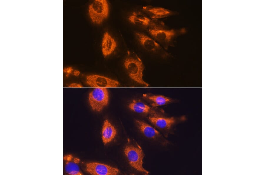 Immunofluorescence - Anti-DAG1 Antibody (A308698) - Antibodies.com